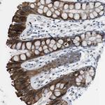 WSCD1 Polyclonal Antibody