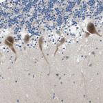 ERGIC3 Polyclonal Antibody