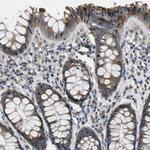 ERGIC3 Antibody in Immunohistochemistry (Paraffin) (IHC (P))
