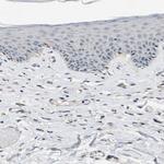 ERGIC3 Antibody in Immunohistochemistry (Paraffin) (IHC (P))