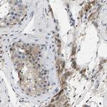 ERGIC3 Antibody in Immunohistochemistry (Paraffin) (IHC (P))