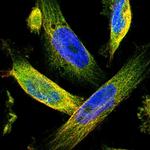 TMEM132C Polyclonal Antibody