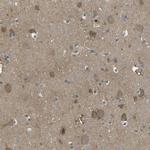 PIEZO2 Antibody in Immunohistochemistry (Paraffin) (IHC (P))