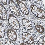 PIEZO2 Antibody in Immunohistochemistry (Paraffin) (IHC (P))