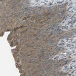 PIEZO2 Antibody in Immunohistochemistry (Paraffin) (IHC (P))