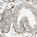 C1orf27 Antibody in Immunohistochemistry (Paraffin) (IHC (P))