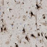 TSPAN3 Antibody in Immunohistochemistry (Paraffin) (IHC (P))
