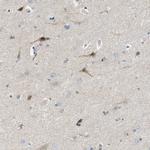 PIGG Antibody in Immunohistochemistry (Paraffin) (IHC (P))