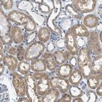 PIGG Antibody in Immunohistochemistry (Paraffin) (IHC (P))