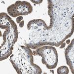 PIGG Antibody in Immunohistochemistry (Paraffin) (IHC (P))