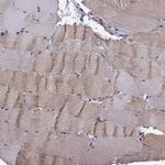 CHST8 Polyclonal Antibody