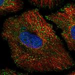 KCNK1 Antibody in Immunocytochemistry (ICC/IF)