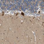 KCNK1 Antibody in Immunohistochemistry (IHC)