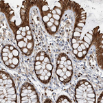 SH3D19 Antibody in Immunohistochemistry (Paraffin) (IHC (P))