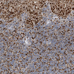 SH3D19 Polyclonal Antibody