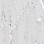 HSD17B12 Antibody in Immunohistochemistry (IHC)