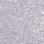 ZNF185 Antibody in Immunohistochemistry (IHC)