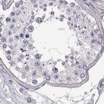 ZNF185 Antibody in Immunohistochemistry (IHC)