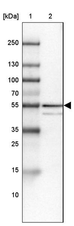 ZNF185 Antibody in Western Blot (WB)