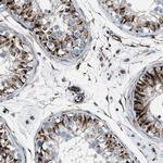 CABP7 Polyclonal Antibody