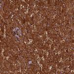 HHAT Antibody in Immunohistochemistry (Paraffin) (IHC (P))