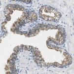 TAUT Antibody in Immunohistochemistry (Paraffin) (IHC (P))