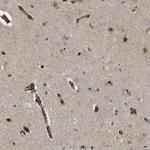 TMTC4 Antibody in Immunohistochemistry (IHC)