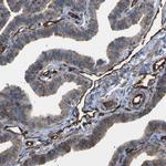 TMTC4 Antibody in Immunohistochemistry (IHC)