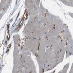 TMTC4 Antibody in Immunohistochemistry (IHC)