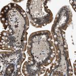 FAM134C Antibody in Immunohistochemistry (Paraffin) (IHC (P))