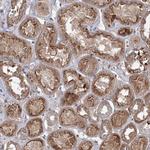 LZK Antibody in Immunohistochemistry (Paraffin) (IHC (P))