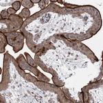 LZK Antibody in Immunohistochemistry (Paraffin) (IHC (P))