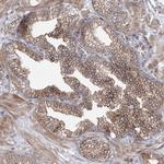 LZK Antibody in Immunohistochemistry (Paraffin) (IHC (P))