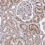 WNK4 Polyclonal Antibody