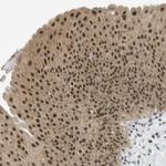 ARID1B Antibody in Immunohistochemistry (Paraffin) (IHC (P))