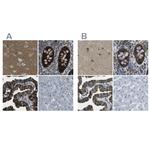WNK2 Polyclonal Antibody