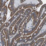 SMIM20 Antibody in Immunohistochemistry (Paraffin) (IHC (P))