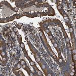 CNPY3 Polyclonal Antibody