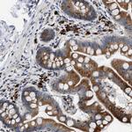 DERL1 Antibody in Immunohistochemistry (IHC)