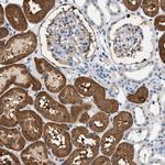 SLC35E1 Antibody in Immunohistochemistry (Paraffin) (IHC (P))