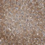 SLC35E1 Antibody in Immunohistochemistry (Paraffin) (IHC (P))