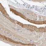 SLC35E1 Antibody in Immunohistochemistry (Paraffin) (IHC (P))