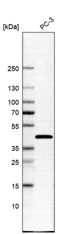 SLC35E1 Antibody in Western Blot (WB)