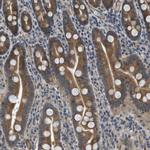 PGAP3 Antibody in Immunohistochemistry (Paraffin) (IHC (P))