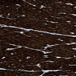 LMBR1 Antibody in Immunohistochemistry (Paraffin) (IHC (P))