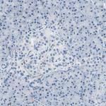 RCSD1 Antibody in Immunohistochemistry (IHC)