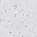 Nebulin Antibody in Immunohistochemistry (Paraffin) (IHC (P))
