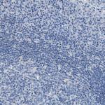 Nebulin Antibody in Immunohistochemistry (Paraffin) (IHC (P))