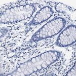 Nebulin Antibody in Immunohistochemistry (IHC)
