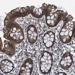 ASC1 Polyclonal Antibody